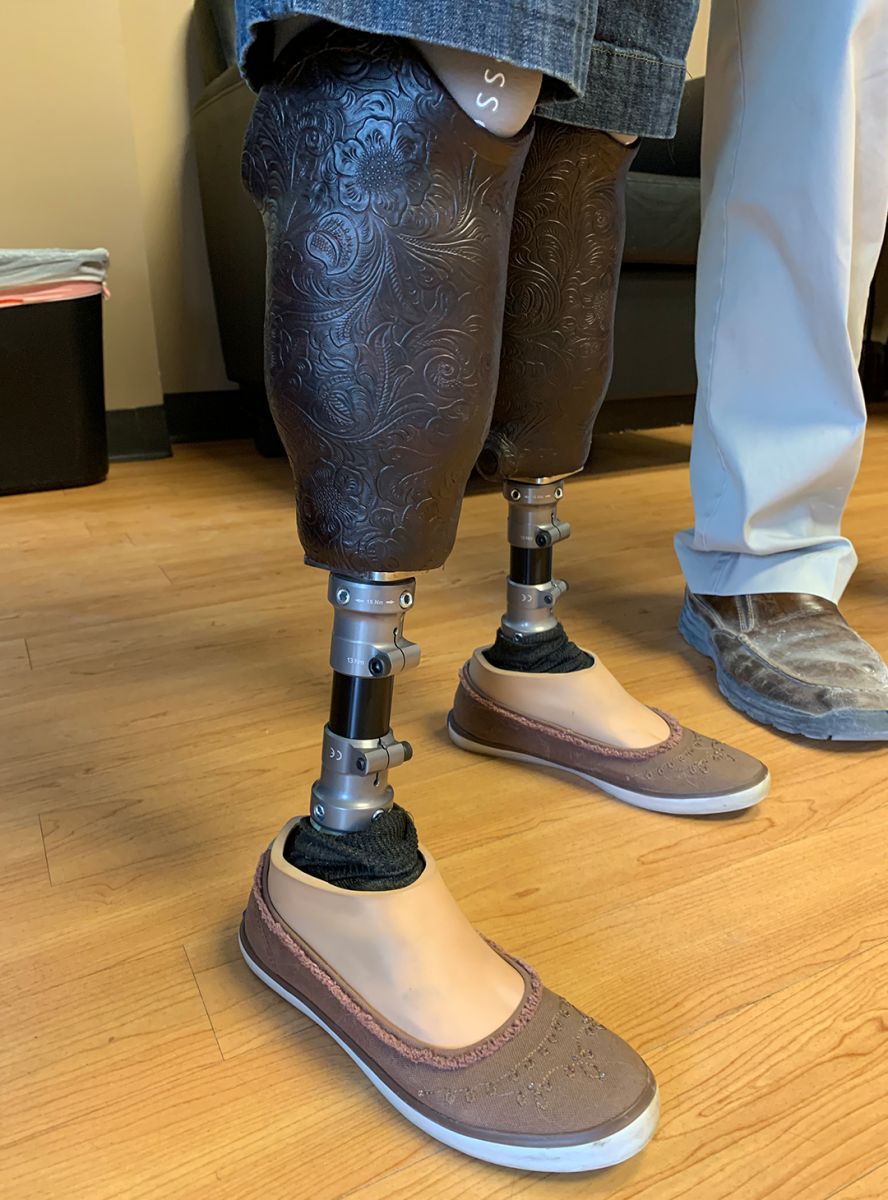 : Image Gallery - Holmes Prosthetic Center | Houston, Texas